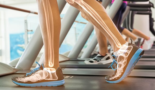 Highlighted bones of man on treadmill